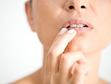 Should I Keep Cold Sores Moist or Dry for Faster Healing?