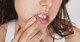Cold Sores and Mouth Ulcers in Early Pregnancy
