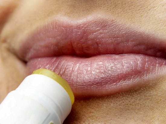 What to do when your cold sores hurt too much